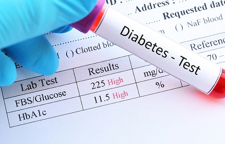 Sugar Test in Ludhiana